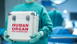 organ donation