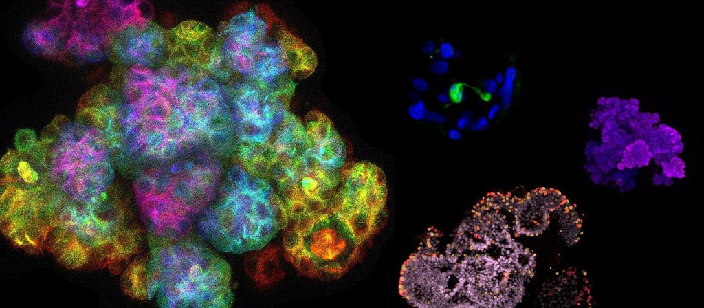 ubd-organoids-title-3200x1400_0