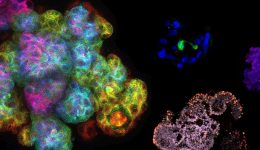 ubd-organoids-title-3200x1400_0